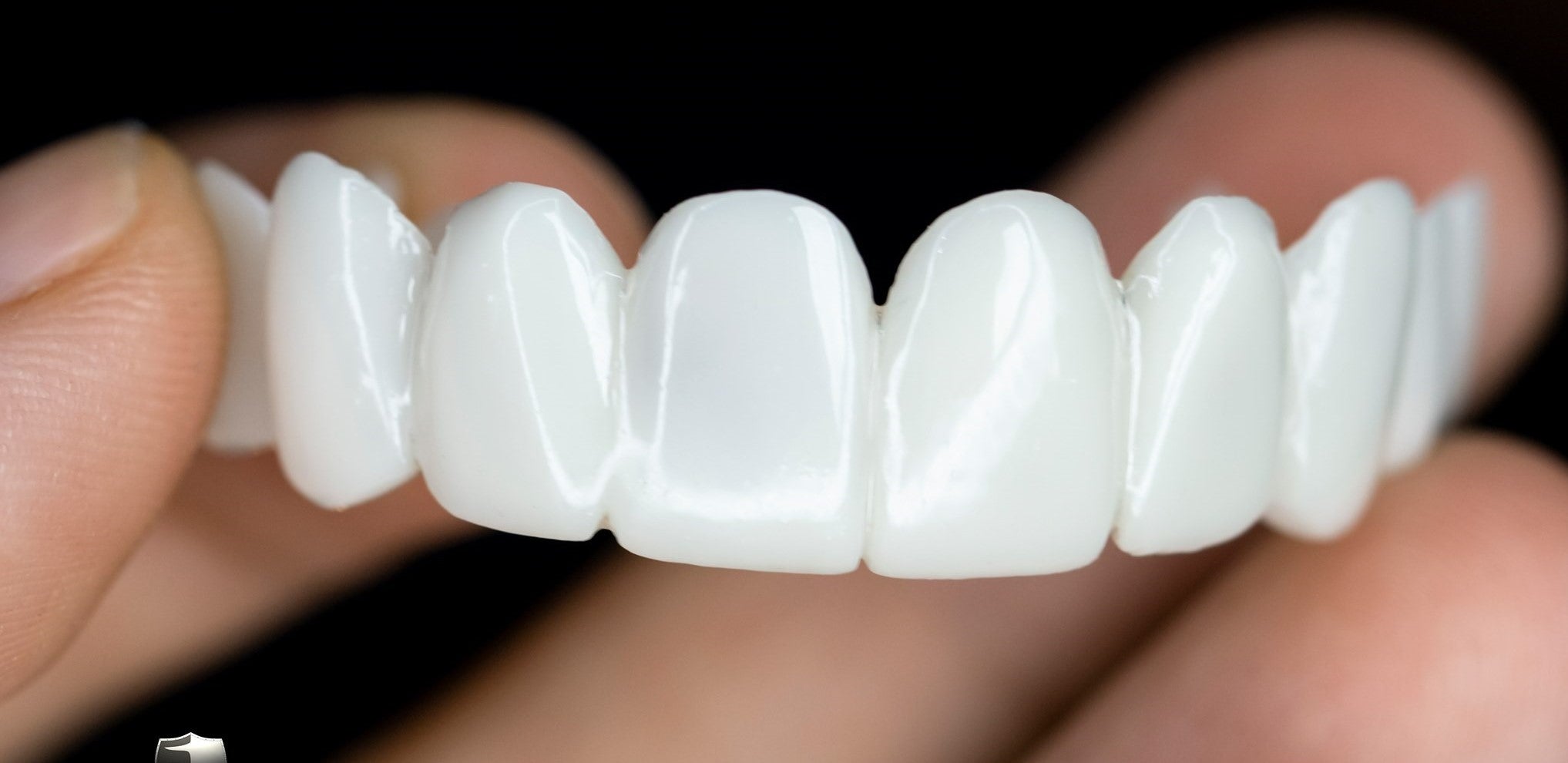 Snap-On Cosmetic Veneers - Instant Smile Cover for Dental Imperfections