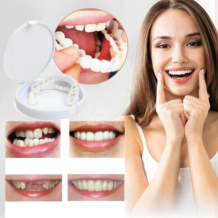 Snap-On Veneers for Upper and Lower Teeth with Removable Smile Cover