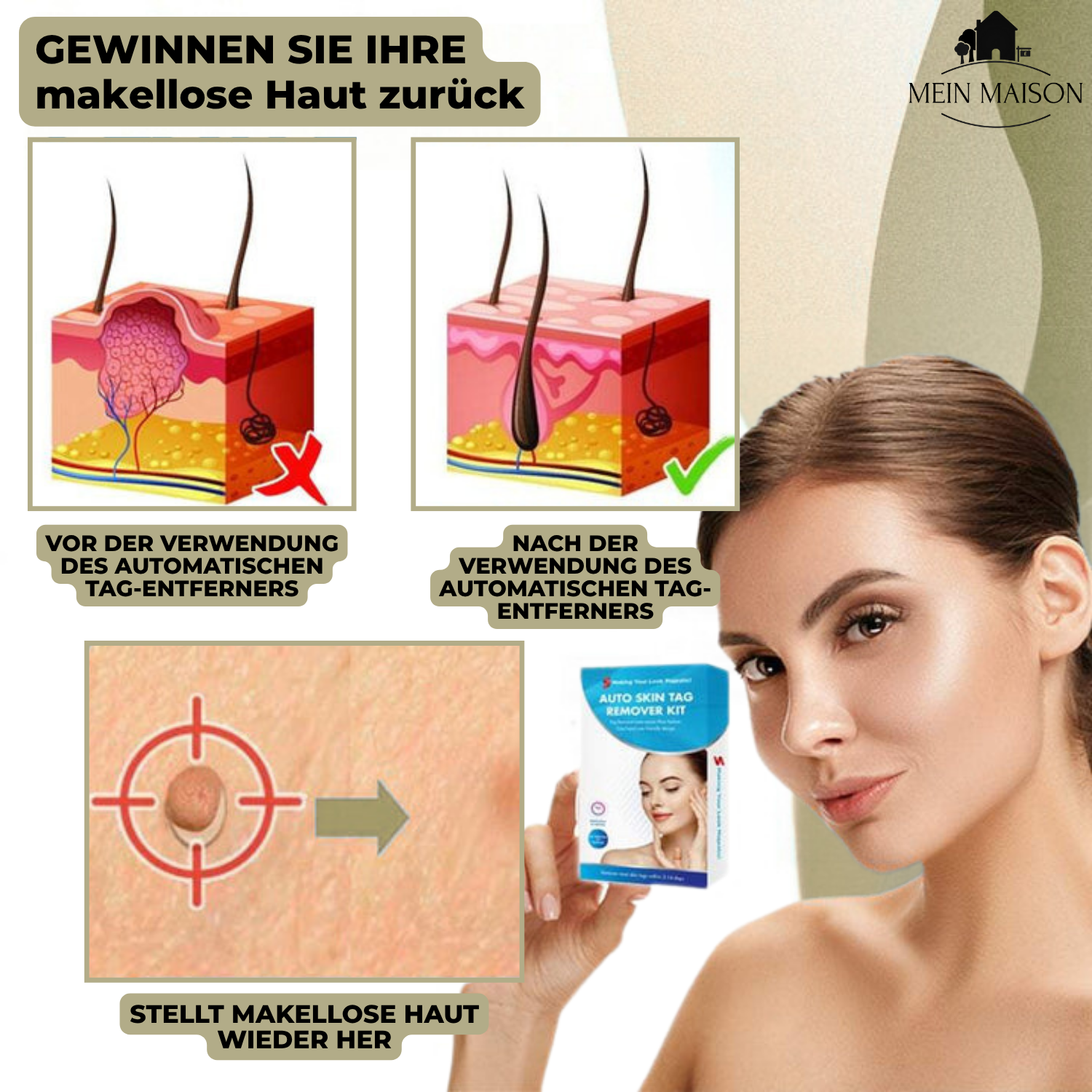 Pain Free At Home Wart and Mole Remover Skin Care Treatment