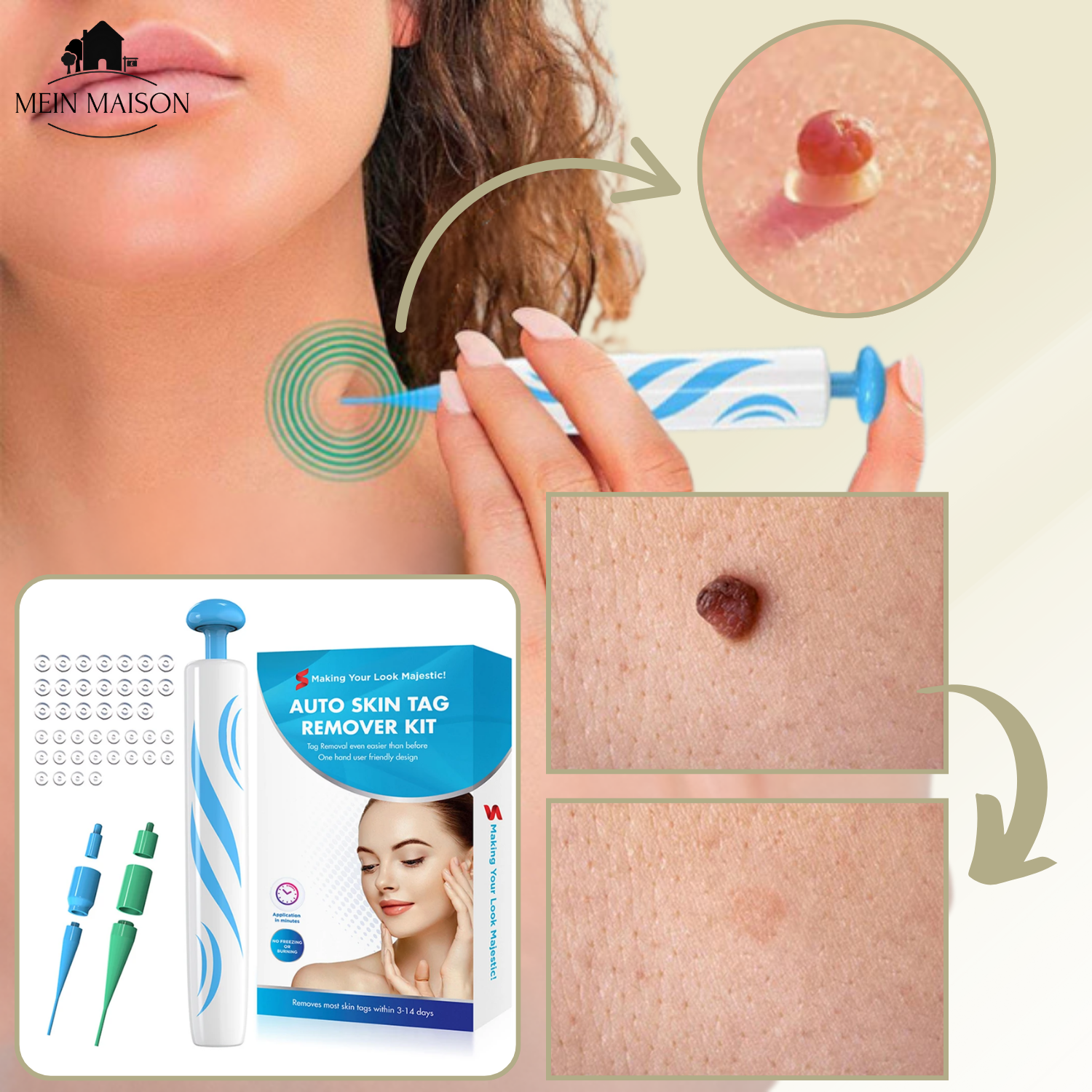 Pain Free At Home Wart and Mole Remover Skin Care Treatment