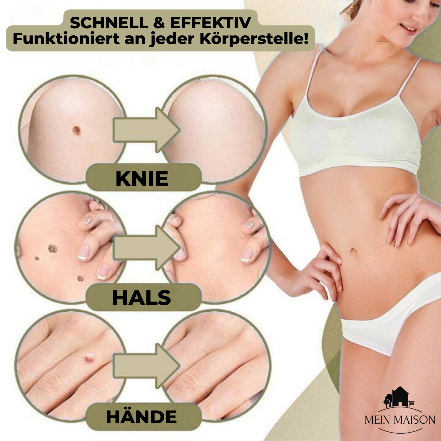 Pain Free At Home Wart and Mole Remover Skin Care Treatment