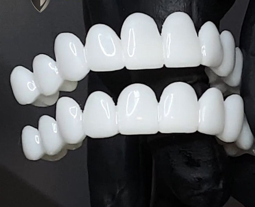 Snap-On Cosmetic Veneers - Instant Smile Cover for Dental Imperfections