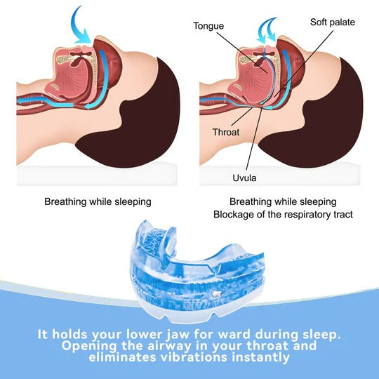AuraaGuard | Adjustable Anti-Snoring Mouthpiece Guard for Comfortable Sleep