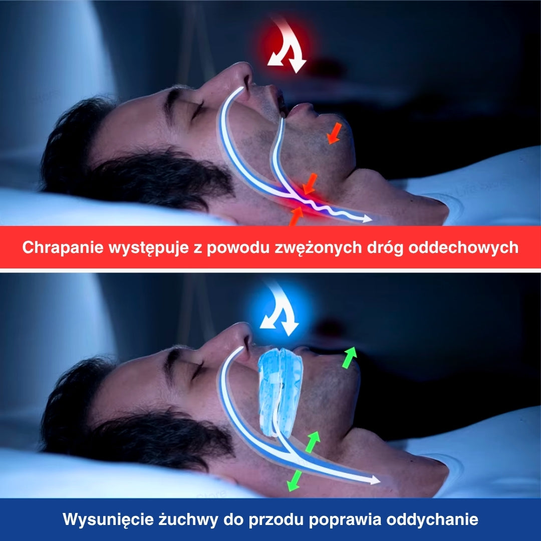 AuraaGuard | Adjustable Anti-Snoring Mouthpiece Guard for Comfortable Sleep