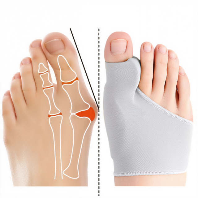 OrthoEase | Comfortable Gel Bunion Corrector with Soft Supportive Cushioning