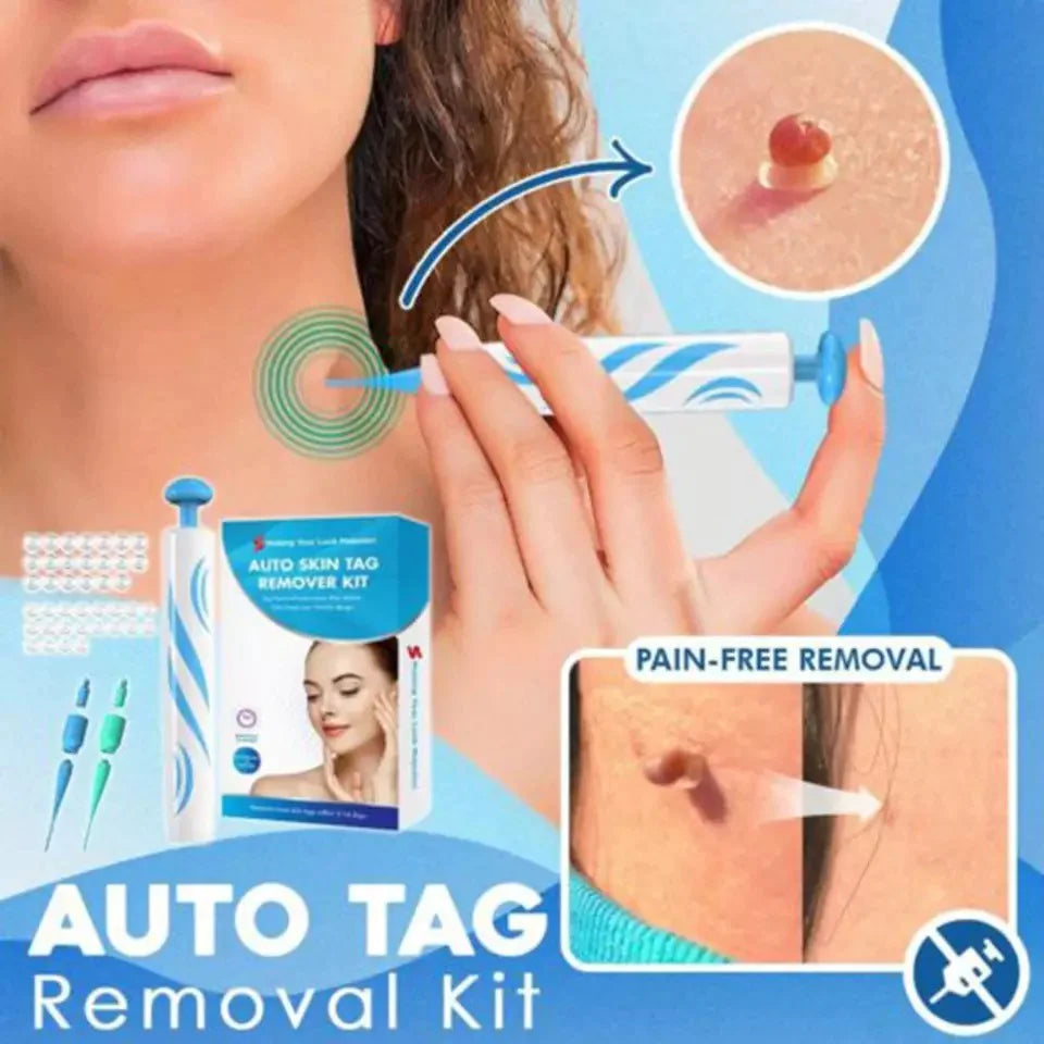 Painless Skin Tag Remover Kit | At-Home Targeted Removal Tool