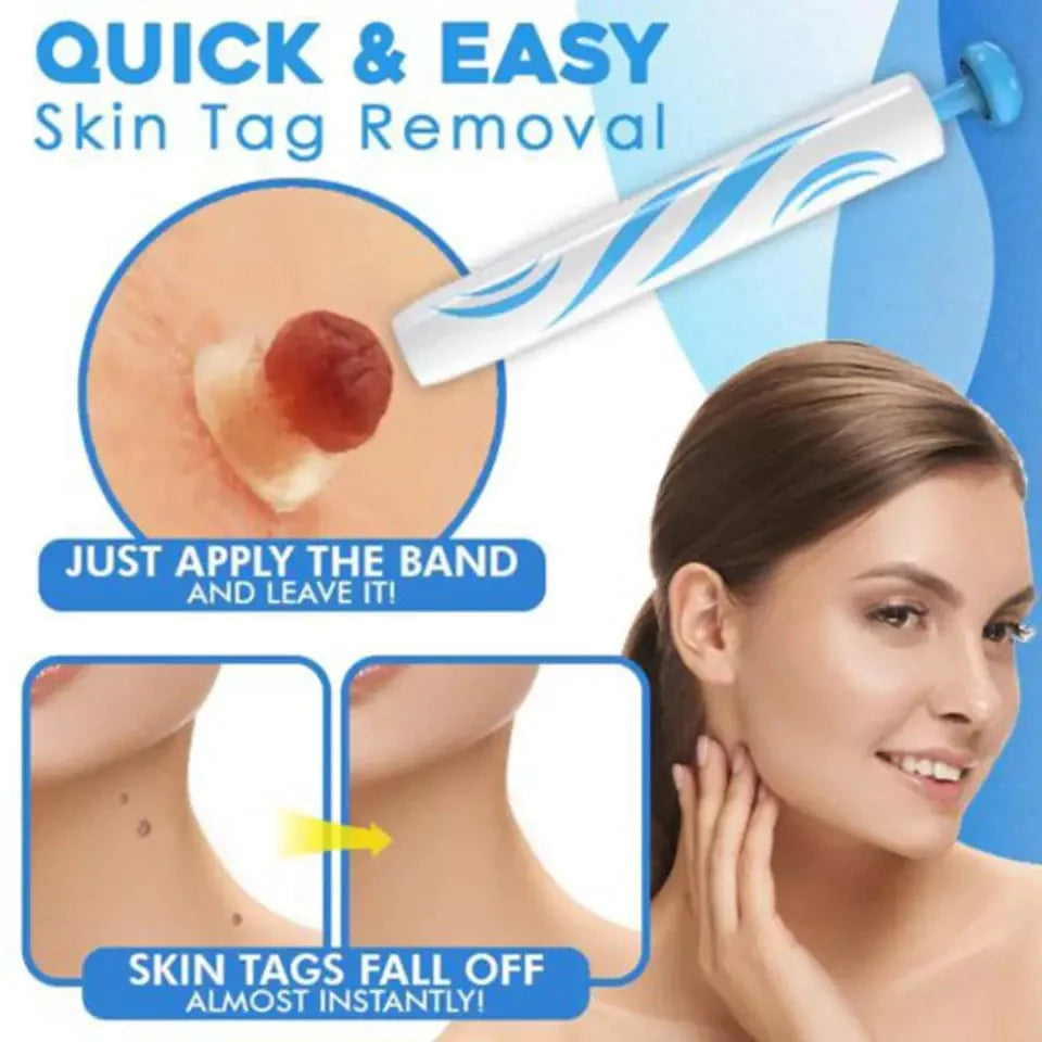 Painless Skin Tag Remover Kit | At-Home Targeted Removal Tool