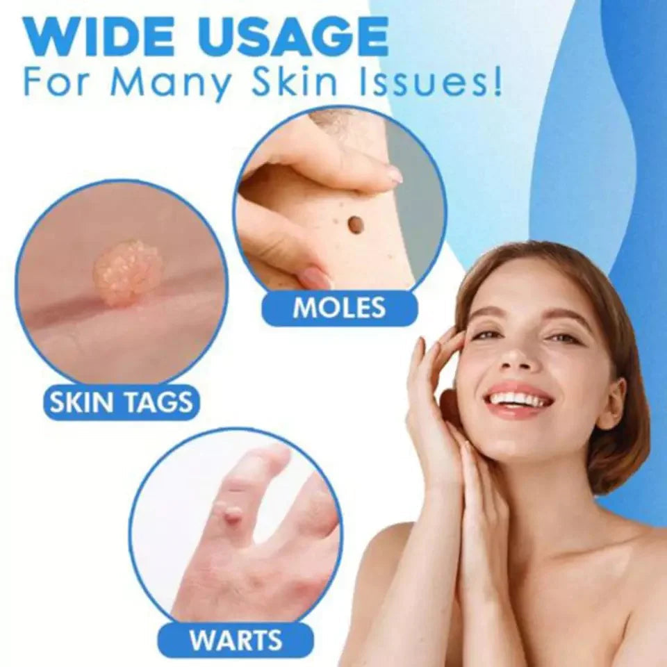 Painless Skin Tag Remover Kit | At-Home Targeted Removal Tool
