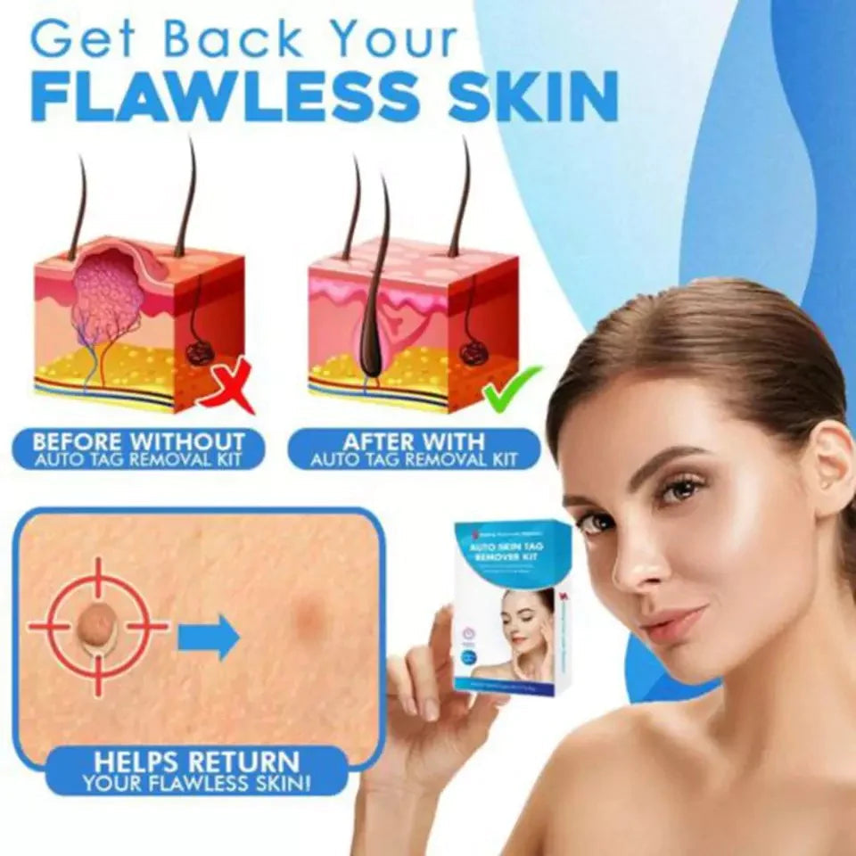 Painless Skin Tag Remover Kit | At-Home Targeted Removal Tool