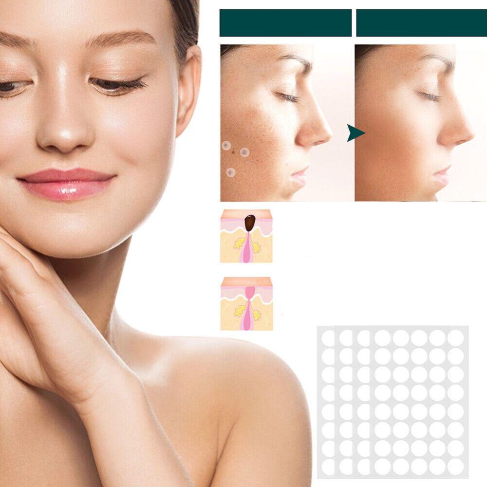 Spot and Wart Removal Patches for Skin Care Kalsten Treatment