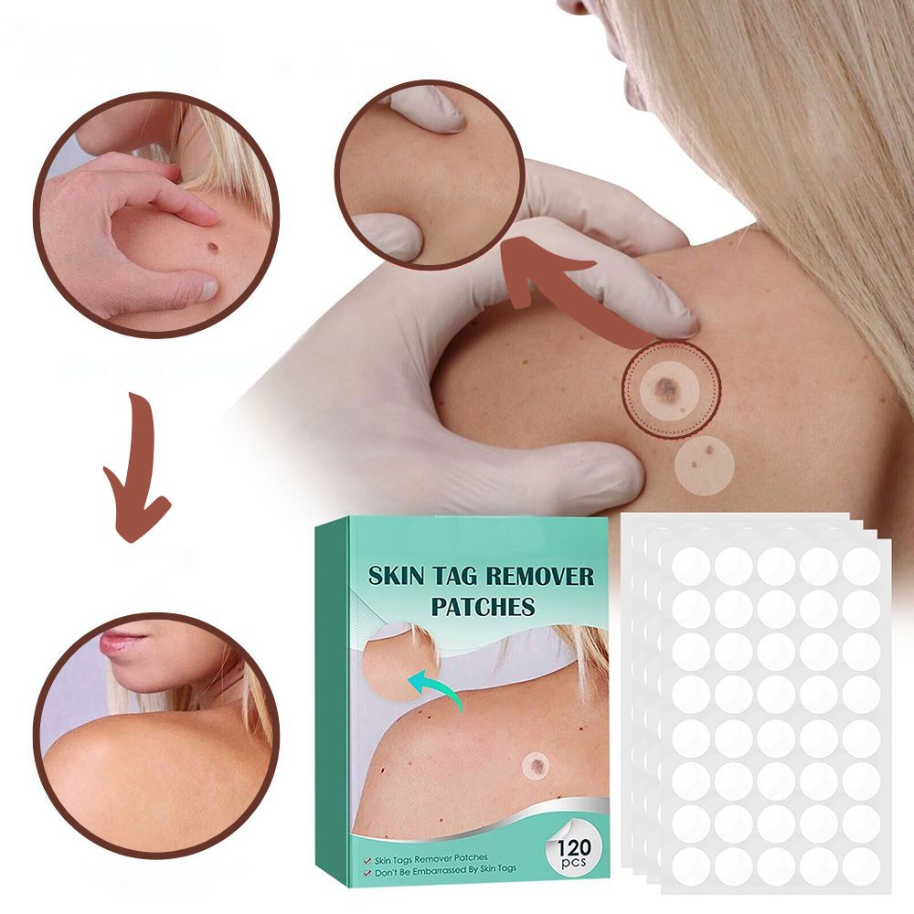 Discreet Skin Clearing Patch for the Removal of Spots and Warts