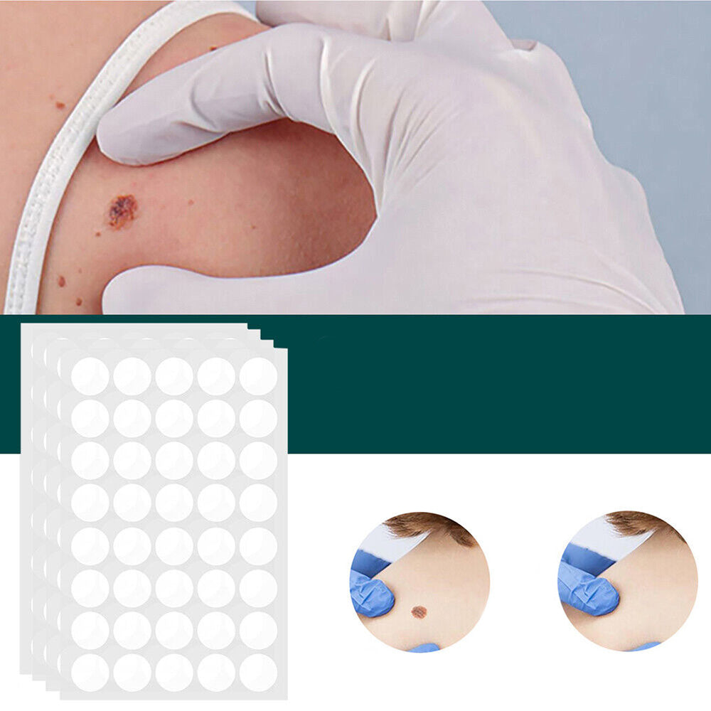 Spot and Wart Removal Patches for Skin Care Kalsten Treatment