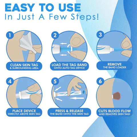 Painless Skin Tag Remover Kit | At-Home Targeted Removal Tool