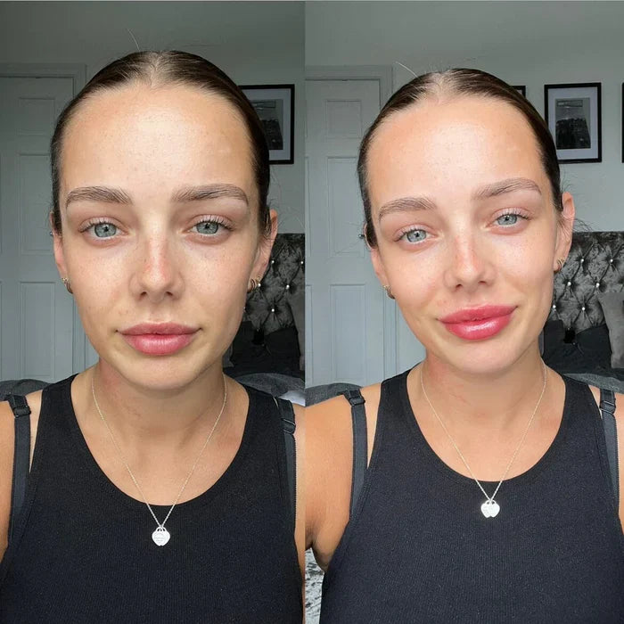 Instant Lip Plumper Serum | Hydrating Lip Filler Gloss for Volume